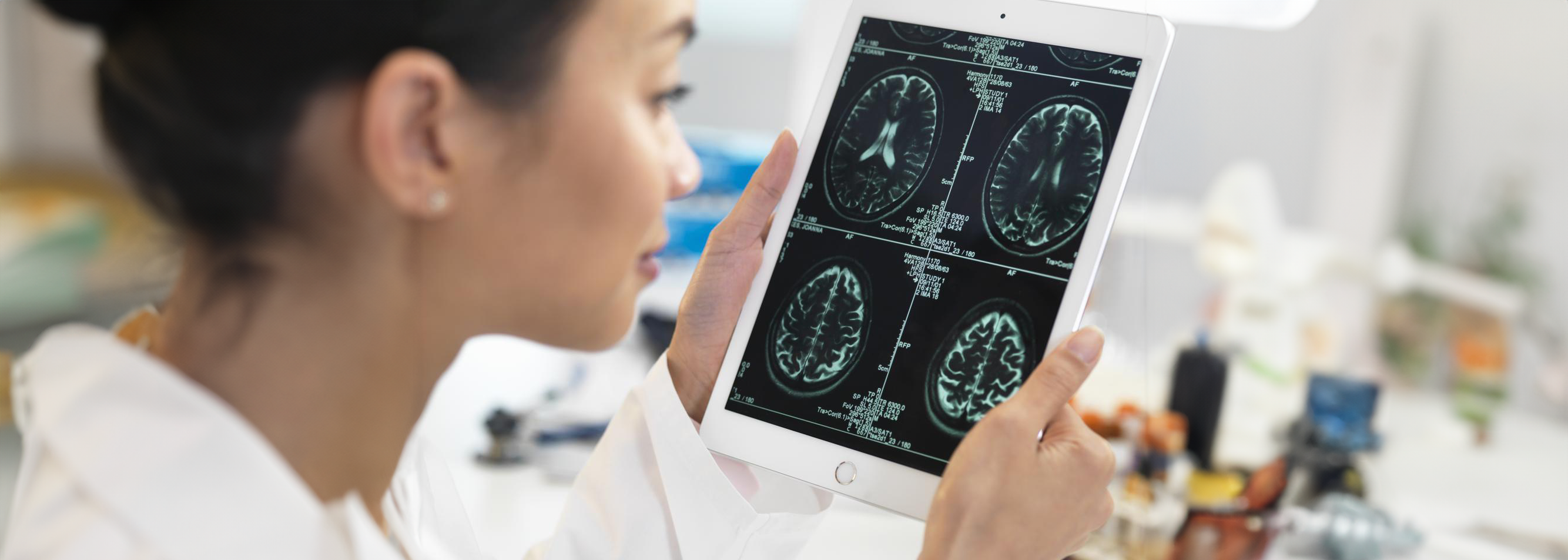 Doctor holding a tablet displaying brain scan images for neurological assessment.